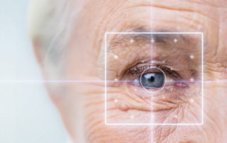 cataract-surgery-are-cataracts-removed-by-laser