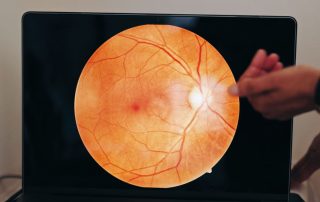 what-happens-if-glaucoma-goes-untreated