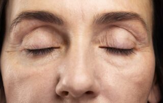 how-eyelid-conditions-can-impact-vision