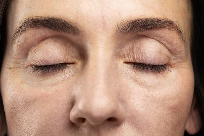 how-eyelid-conditions-can-impact-vision
